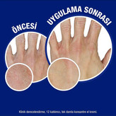 کرم مرطوب کننده دست نوتروژینا مناسب پوست خشک و ترک خورده